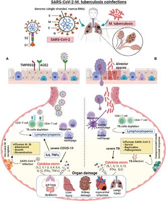 Frontiers | Pathogenesis Of SARS-CoV-2 And Mycobacterium Tuberculosis ...